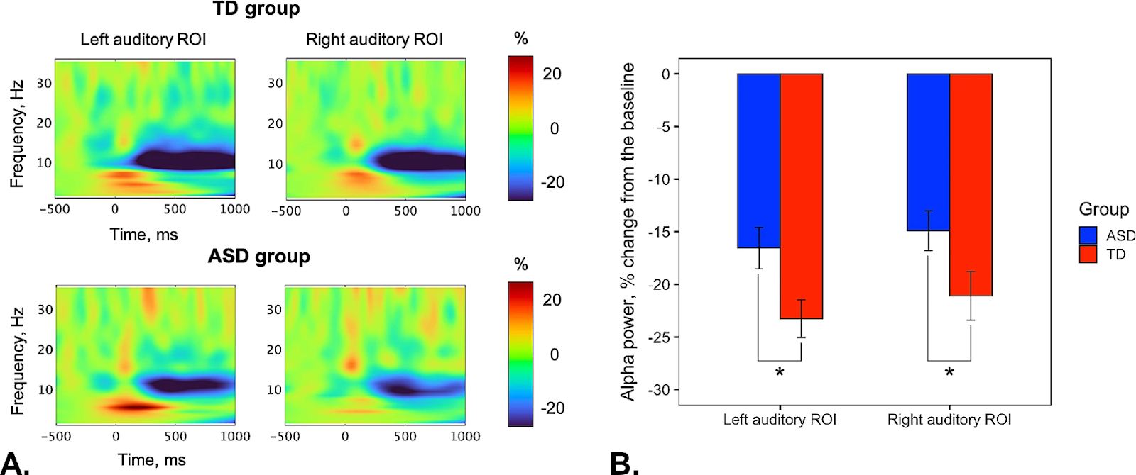 Fig. 1. Comparison of response to auditory stimuli between children with and without ASD. A. Time-frequency maps of alpha-band activity in the auditory regions of the left and right hemispheres for both groups of children. B. Between-group differences in alpha-band event-related desynchronization (ERD) as a percentage of baseline levels at rest (source: Arutiunian et al., 2024, Brain Structure and Function)